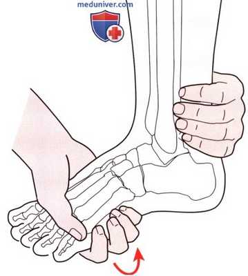 Исследование пассивных движений в голеностопном суставе и стопе