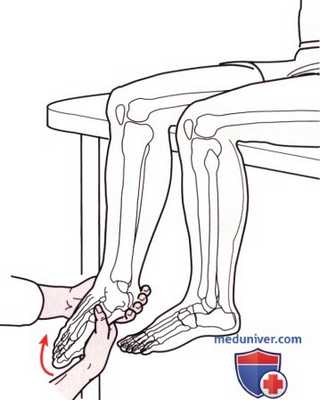 Исследование пассивных движений в голеностопном суставе и стопе