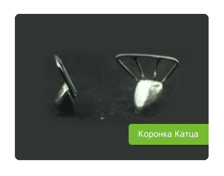 коронка Катца