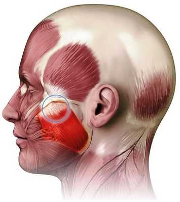 Парафункция жевательных мышц