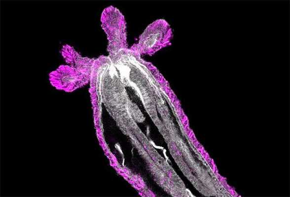 Гаструла актинии