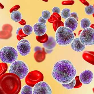 Хронические миелопролиферативные заболевания