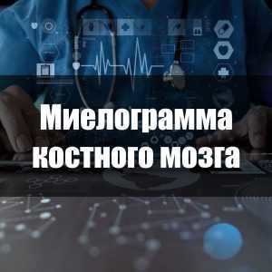 Миелограмма костного мозга