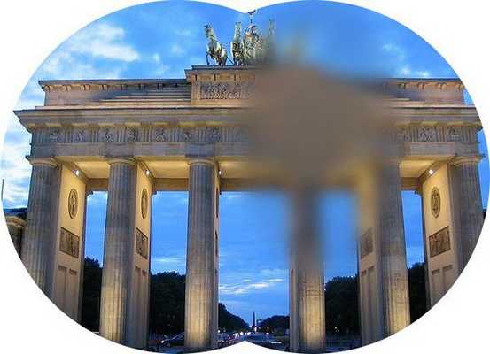 Аура при мигрени