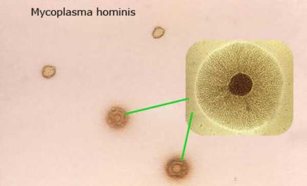Mycoplasma hominis