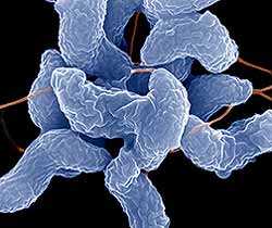 Кампилобактер (campylobacter)