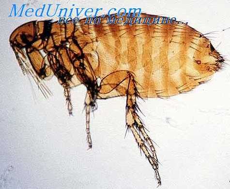 диагностика сыпного тифа