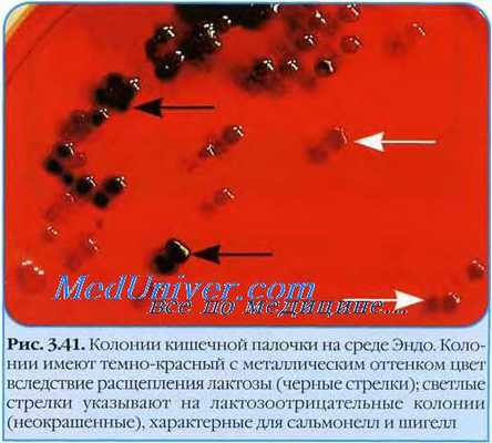 Эшерихии. Эшерихиозы. Свойства эшерихий. Кишечная палочка. Escherichia coli. Морфология кишечной палочки