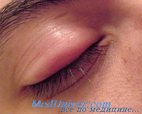 бактерии вызывающие инфекцию