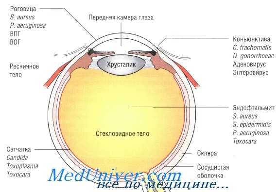 причины глазных инфекций