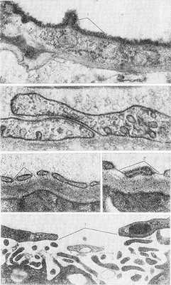 Рис. 4. Электронограмма элементов стенки кровеносных капилляров: а — внутримозговой капилляр (1 — гликопротеидовое покрытие, 2 — эндотелиоцит); х 60 000; б — межклеточный контакт в эндотелиальной оболочке гломерулярного капилляра почки (1 — цитоплазма соседних эндотелиоцитов, 2 — контактирующие цитолеммы, 3 - межмембранный промежуток); х 90 000; в и г — гломерулярные капилляры почки (1 - открытые фенестры; 2 — диафрагмальные фенестры в цитоплазме эндотелиоцитов); X 70 000; д — стенка синусоидного капилляра печени (1 — прерывистый контакт между смежными эндотелиоцитами 2); х 35 000.