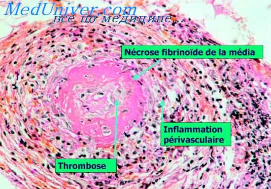 микрохирургия