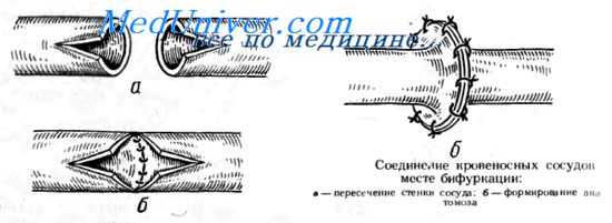 микрохирургия