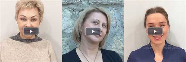 Видео отзывы после пластики лица