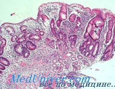 минералкортикоидная функция надпочечников