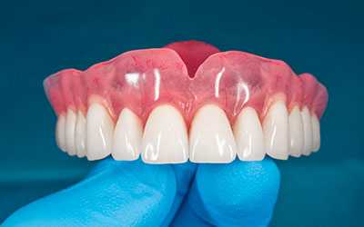 Изготовить съемный протез - Стоматология Линия Улыбки