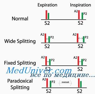 шумы сердца взрослых