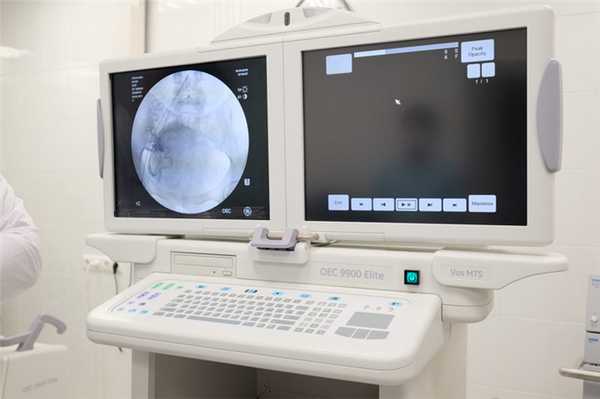 эмболизация - фото из операционной