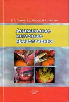 лечение миомы матки