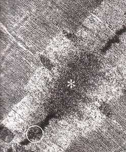 Электронная фотография мышечного волокна человека после выполнения эксцентрических упражнений. Обозначения: * - миофибриллы с разрушенными Z-дисками; миофибрилла с неповрежденным Z диском. По: J.G.Yu, L.Carlsson, L.E. Thomell, 2004.