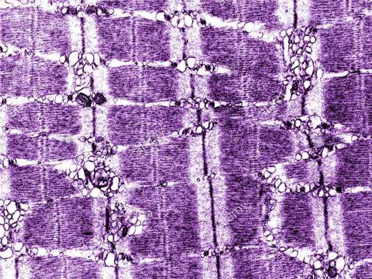 Миофибриллы