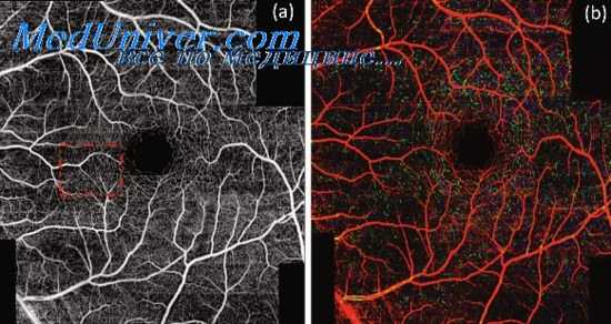 артериальные сосуды