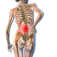 Мышечно-тонический синдром