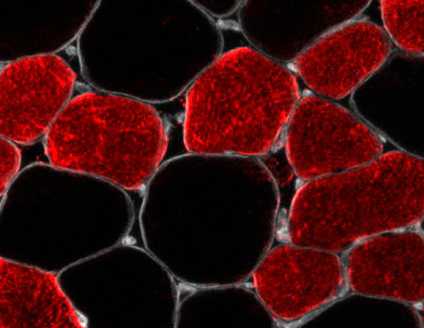 Типы мышечных волокон