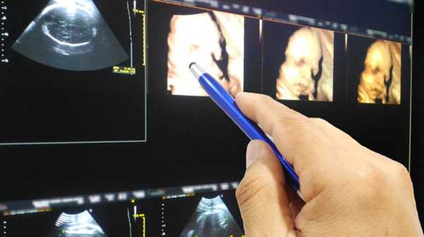 Развитие ребенка в утробе матери