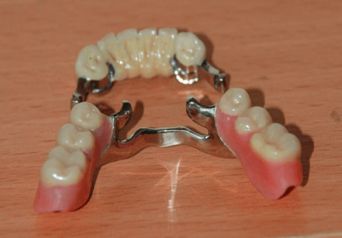 бюгельный протез на аттачменах фото