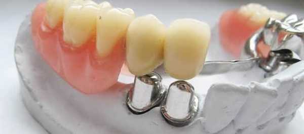 виды аттачментов