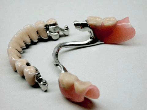 бюгельный протез на аттачменах что это