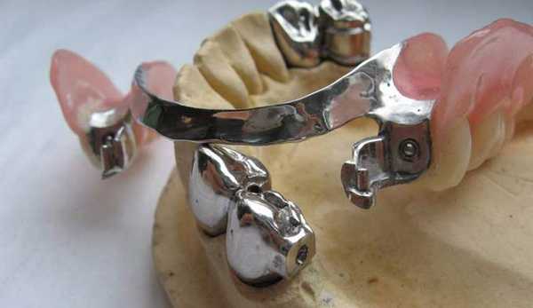 аттачмены бредент