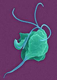 Сходящееся косоглазие