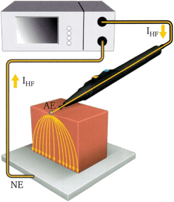 Электротравма