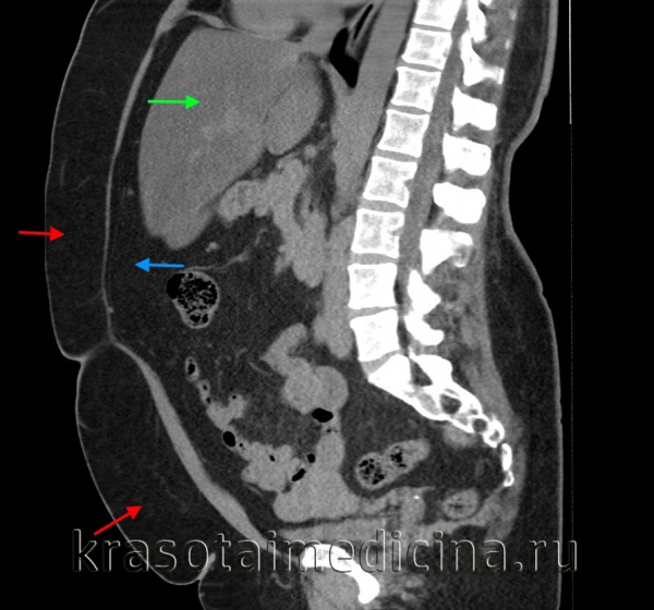 Хитарьян Александр Георгиевич, флеболог, проктолог, бариатрический хирург, онколог, хирург, малоинвазивный хирург, лазерный хирург, абдоминальный хирург, диабетолог, онколог-проктолог, сосудистый хирург, хирург-эндокринолог - Ростов-на-Дону
