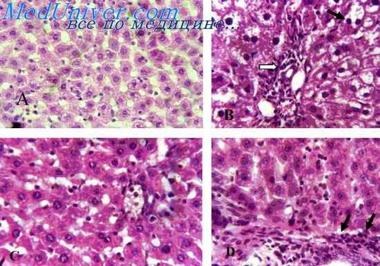 лучевое поражение печени