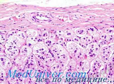 адрено-генитальный синдром