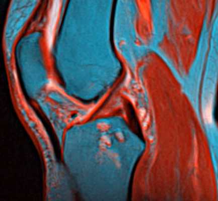 колено в цвете