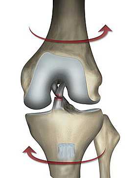 mexanizm-razryva-svyazok