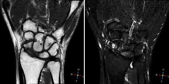 МРТ кисти: когда назначается?