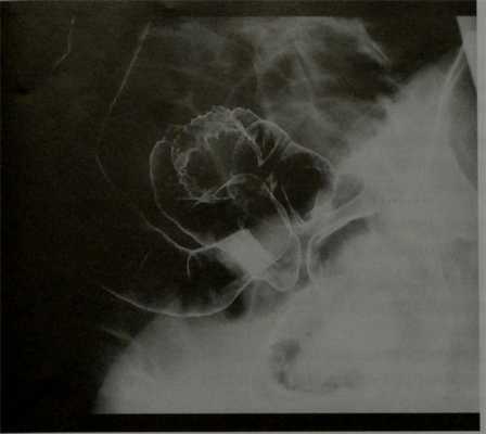 Агапов Михаил Андреевич, проктолог, хирург, онколог, онколог-проктолог - Москва