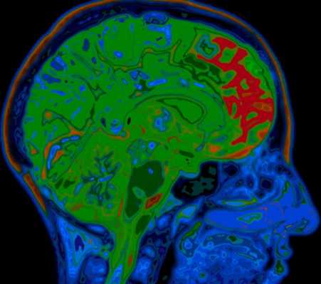 болезнь Пика