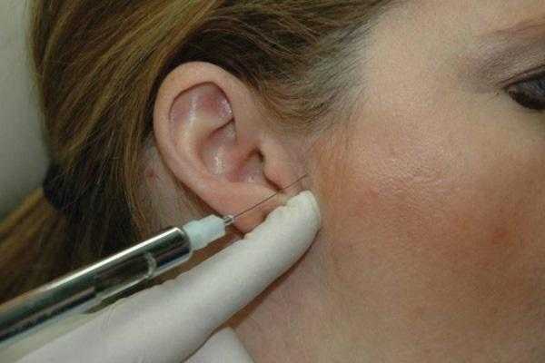 Лечение смещения суставного диска без сопровождающейся редукции