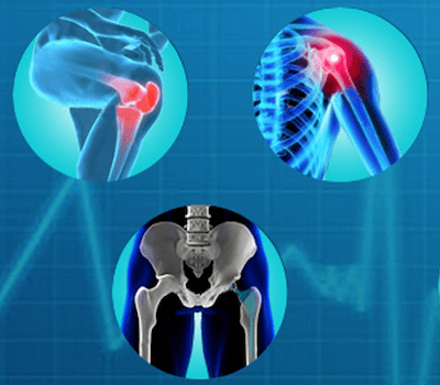 Что покажет МРТ лучезапястного сустава