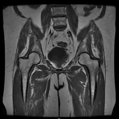 Что показывает МРТ таза?