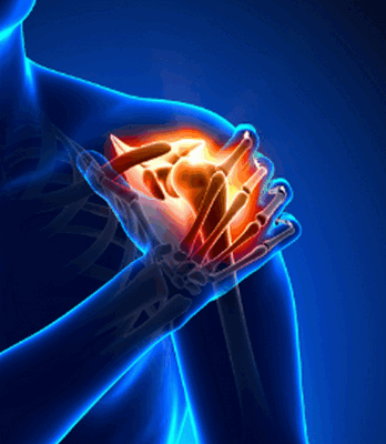 УЗИ плечевого сустава при повреждении сухожилий