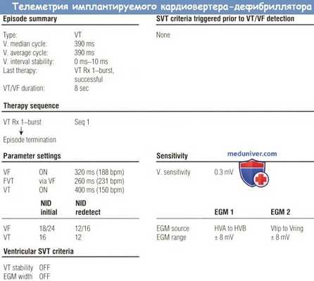 Телеметрия искусственного кардиовертера-дефибриллятора (ИКД)
