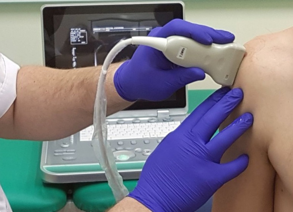 Артрит плечевого сустава