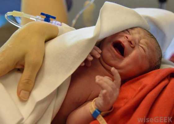 Гипогликемия новорождённого